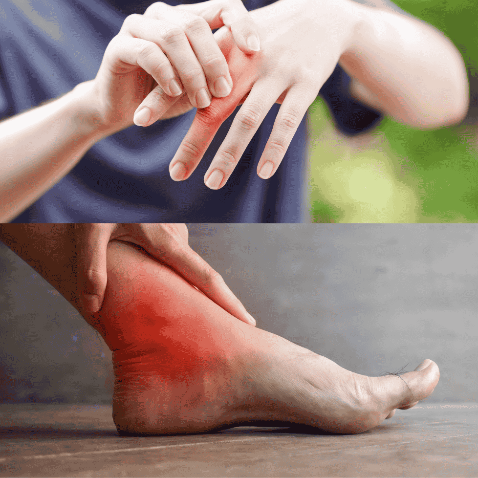 Arthritis Care