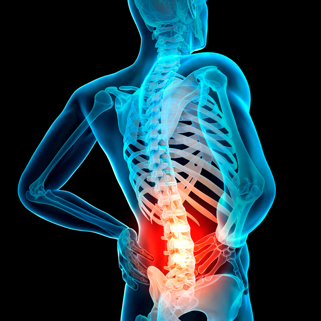 Spine Surgery